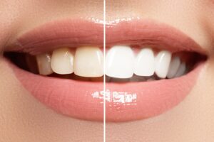 teeth